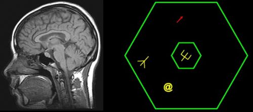 Мозг и компьютерная игра