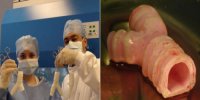 Хирурги, выполнившие пересадку Хирурги, выполнившие пересадку