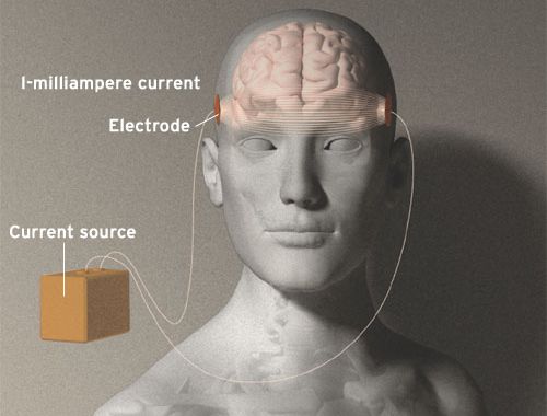   tDCS